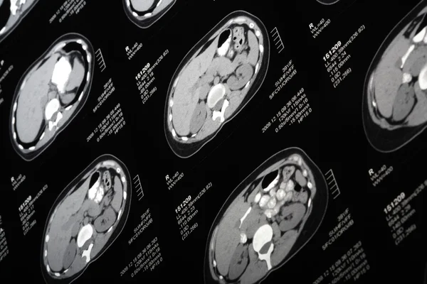 stock image MRI scan tilt view.