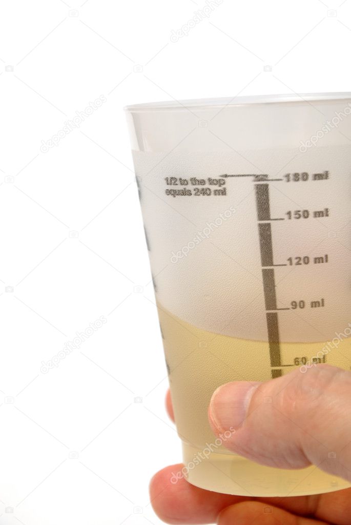 Man holding urine sample