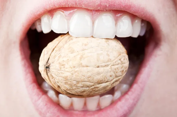 Woman eating hard nut — Stock Photo, Image