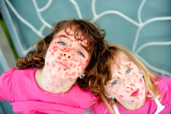 口紅麻疹を装って子女の子いたずら — ストック写真
