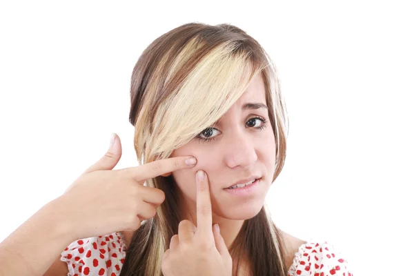 Acne facial cuidado adolescente mulher espremendo espinha no branco — Fotografia de Stock
