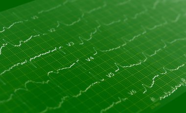 EKG grafiği, Elektrokardiyogram ekg yeşil arka plan doku