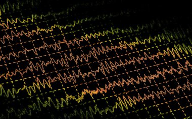 Brain wave on electroencephalogramme EEG for epilepsie clipart