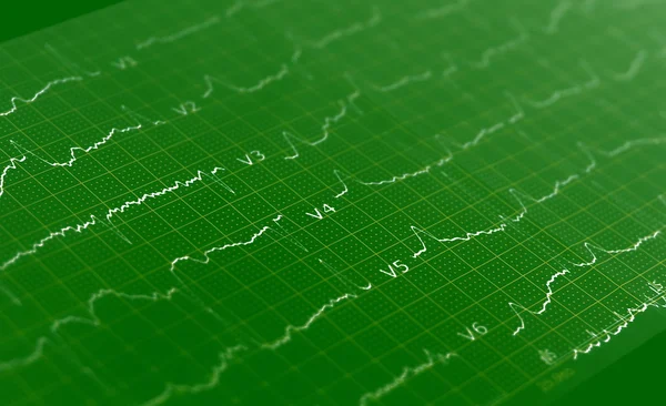 EKG wykres, elektrokardiogram ekg zielone tło, tekstura — Zdjęcie stockowe
