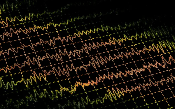 Mozkových vln na electroencephalogramme eeg pro epilepsie — Stock fotografie