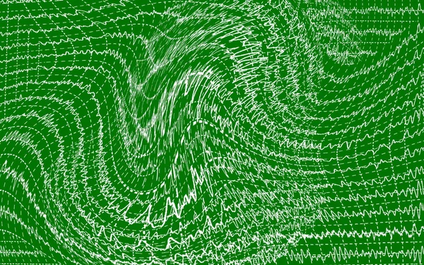 stock image Concept brain wave on green backgrounds, textures