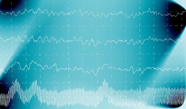 Brain wave on electroencephalogram EEG for epilepsy clipart