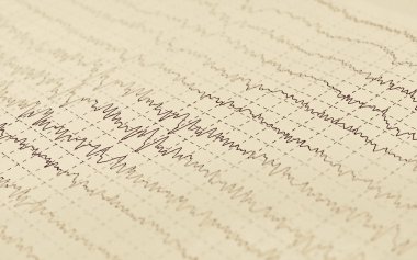 Brain wave (aged newspaper) electroencephalogram EEG for epilepsy clipart