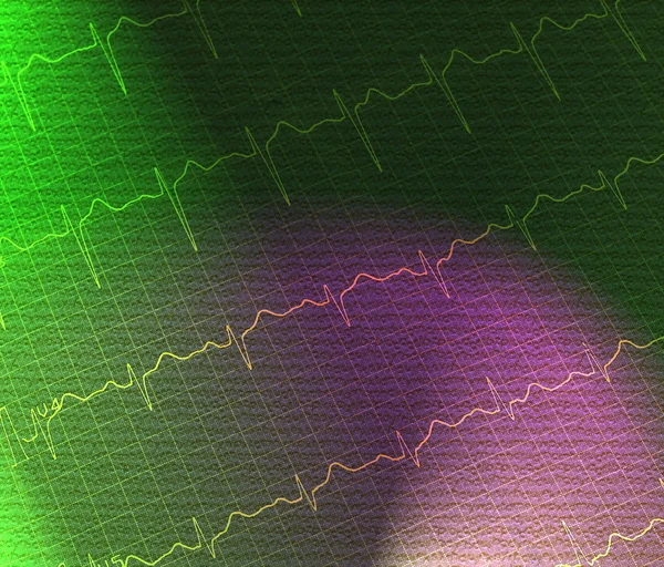 ECG grafiek, elektrocardiogram ekg groene achtergrond, textuur — Stockfoto