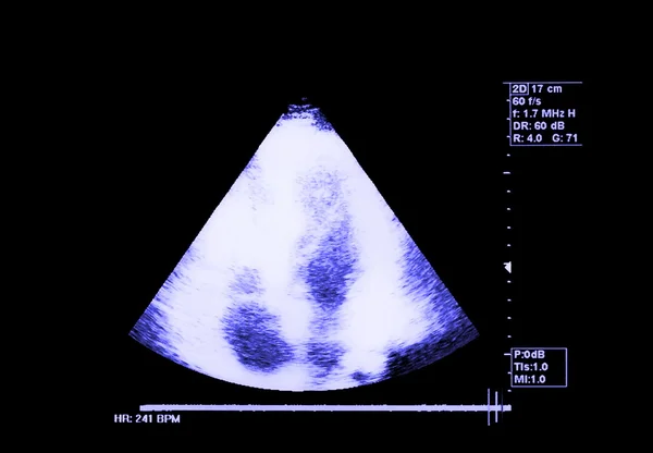 Ultra-som cardíaco para fundo e textura — Fotografia de Stock