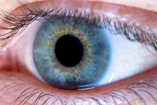 Auge und Kontaktlinse — Stockfoto