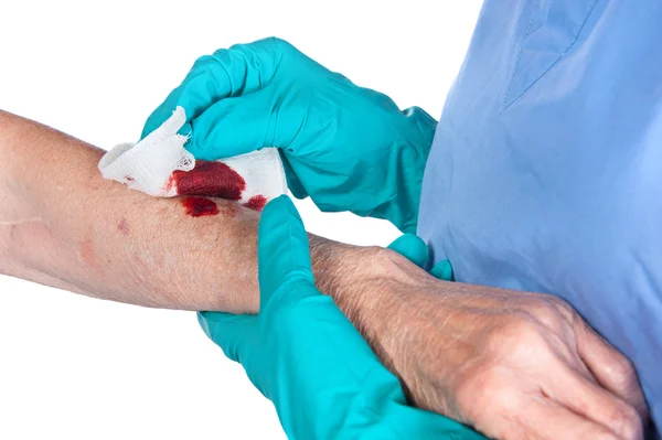Sjuksköterska att ta hand om sår — Stockfoto