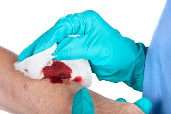 Bloody wound — Stock Photo, Image