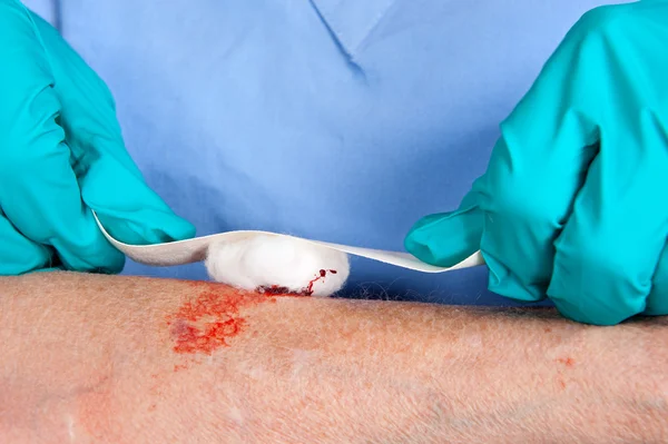 Nurse caring for wound — Stock Photo, Image