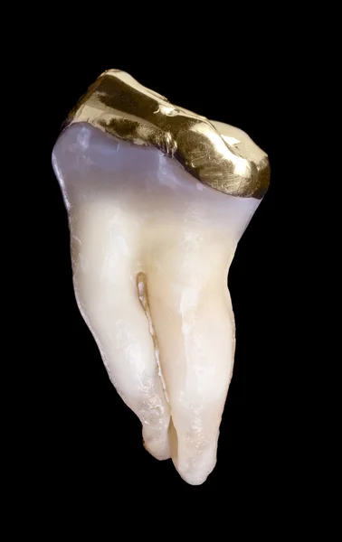 Human molar tooth — Stock Photo, Image