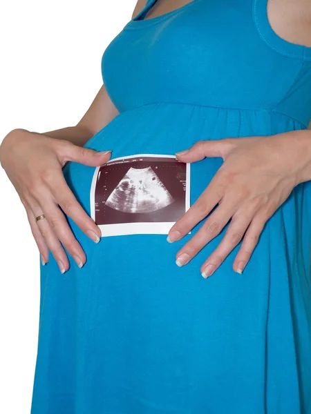 La femme enceinte tient une image d'ultrasons de l'enfant — Photo