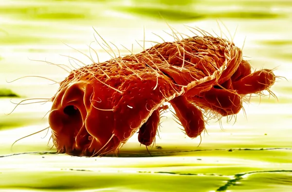 Makroaufnahme eines Parasiten im menschlichen Körper — Stockfoto