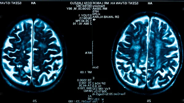Closeup of a computer axial tomography scan (CAT scan) — Stock Photo, Image