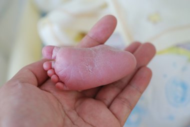 New born infant in the operation room