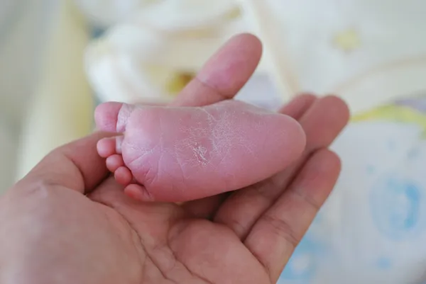 Neugeborenes im Operationssaal — Stockfoto