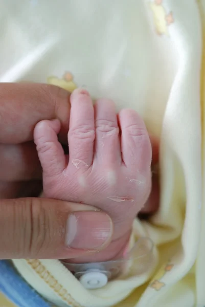Новорожденный младенец в операционной — стоковое фото