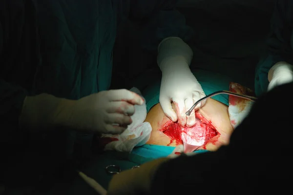 新出生的婴儿在手术室里 — 图库照片