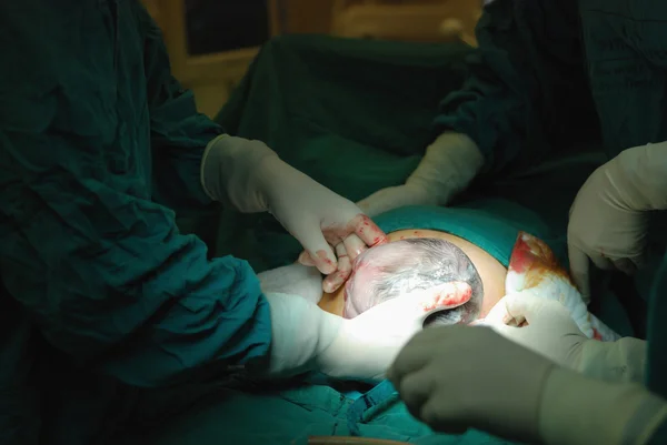 Nowo narodzone niemowlę w sali operacji — Zdjęcie stockowe
