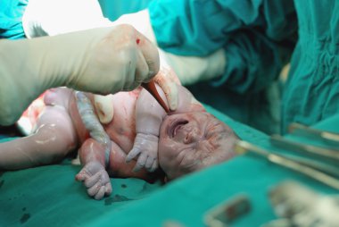 operasyon odasında bebek