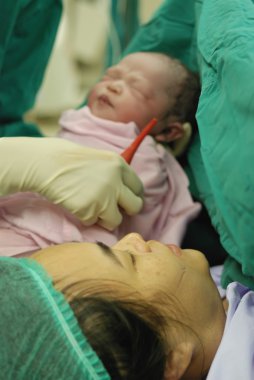 operasyon odasında bebek