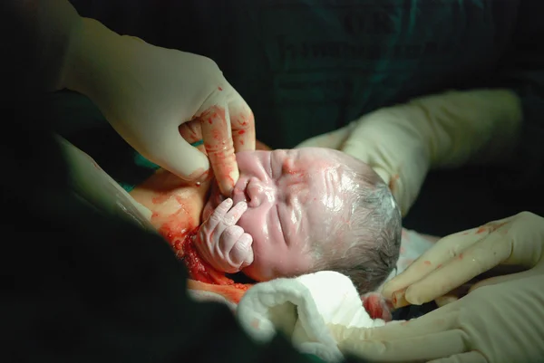 Bayi di ruang operasi. — Stok Foto
