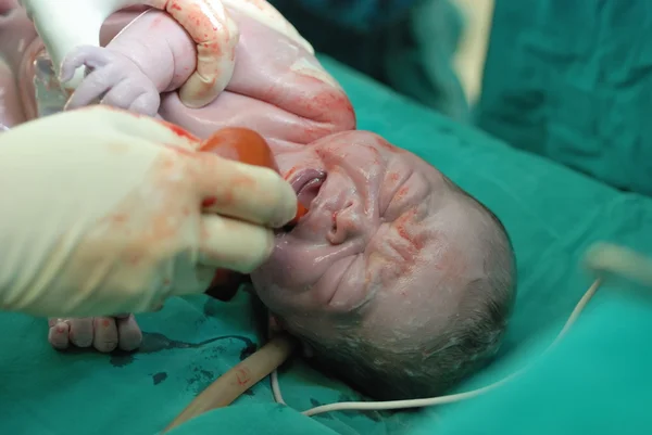 Operasyon odasında bebek — Stok fotoğraf