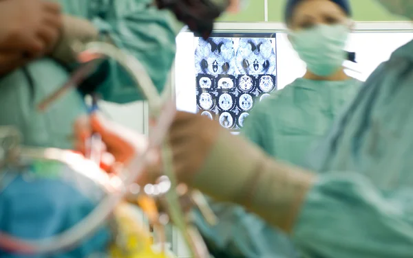 Röntgen-Operation des Gehirns — Stockfoto