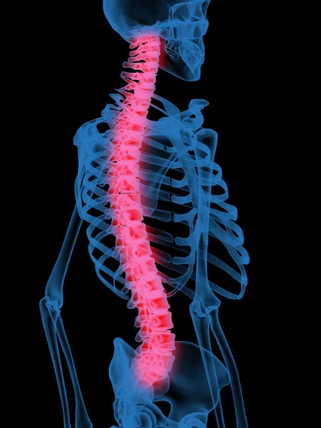 Röntgenbild der menschlichen Wirbelsäule — Stockfoto