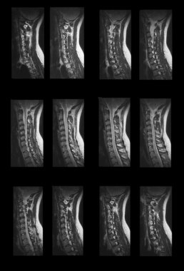 MRI Diagnostics clipart