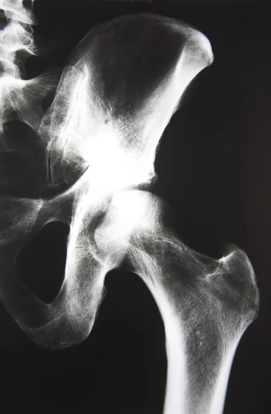 X射线诊断 图库图片