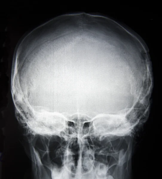 X射线诊断 免版税图库图片