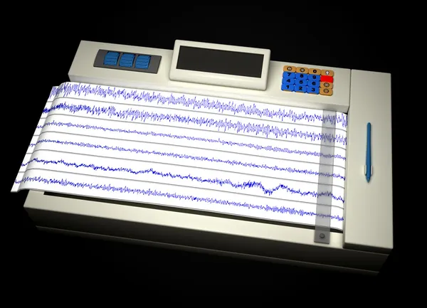 stock image Encephalogram