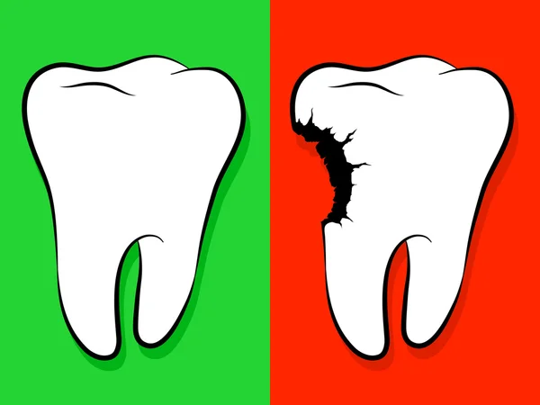 Egészséges és egészségtelen fogat rajzfilm fogszuvasodás — Stock Vector