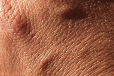Skin close-up clipart