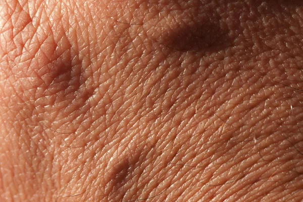 Close-up da pele — Fotografia de Stock
