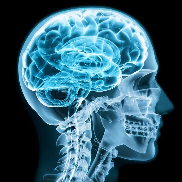 X 射线关闭与脑和颅骨的概念 — 图库照片