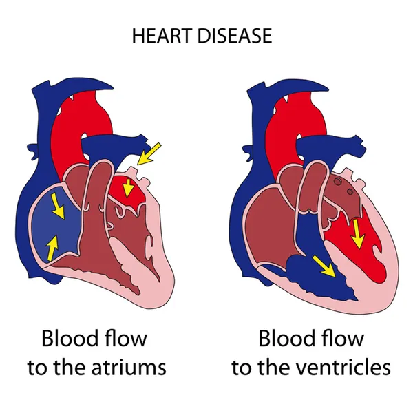 Conducto arteriosus1 — Vector de stock