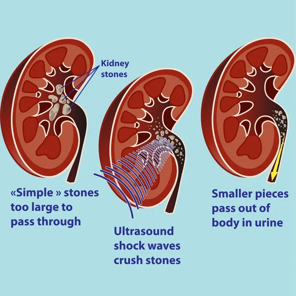 Kidneys — Stock Vector