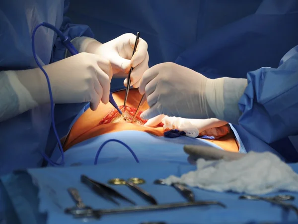 Хірургічна операція — стокове фото
