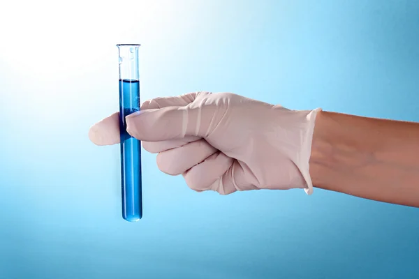 Tubo de ensaio com líquido na mão do médico no fundo azul — Fotografia de Stock