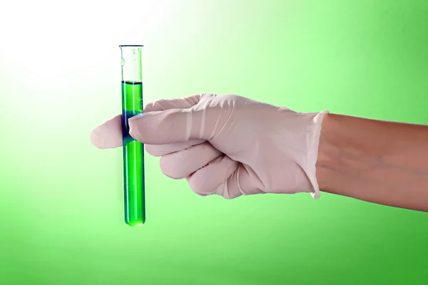 Tubo de teste com líquido na mão do médico no backgrou verde — Fotografia de Stock