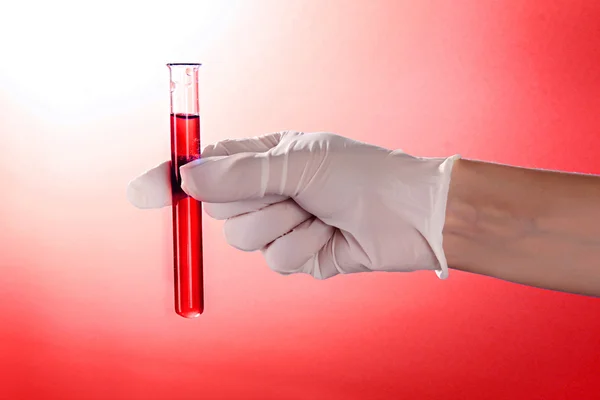 Tubo de ensayo con sangre en la mano del médico sobre el fondo rojo —  Fotos de Stock