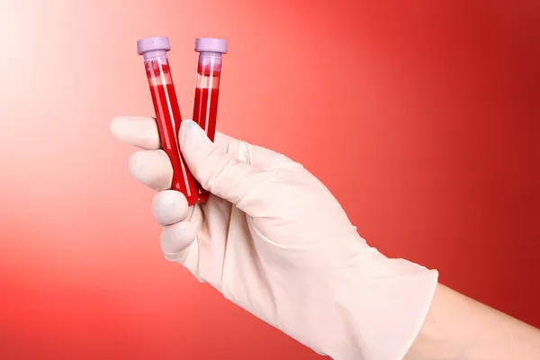 Reageerbuisjes met bloed in de hand op rode achtergrond — Stockfoto