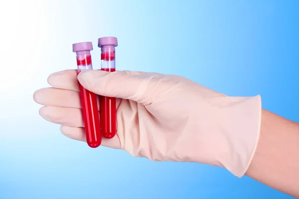 파란색 배경 위에 손에 혈액 테스트 튜브 — 스톡 사진