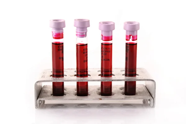 Ιατρική δοκιμαστικούς σωλήνες με το αίμα στο holder σε άσπρο φόντο — Φωτογραφία Αρχείου
